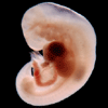 Embryo 32 Tage alt