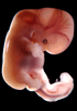 Embryo 47 Tage